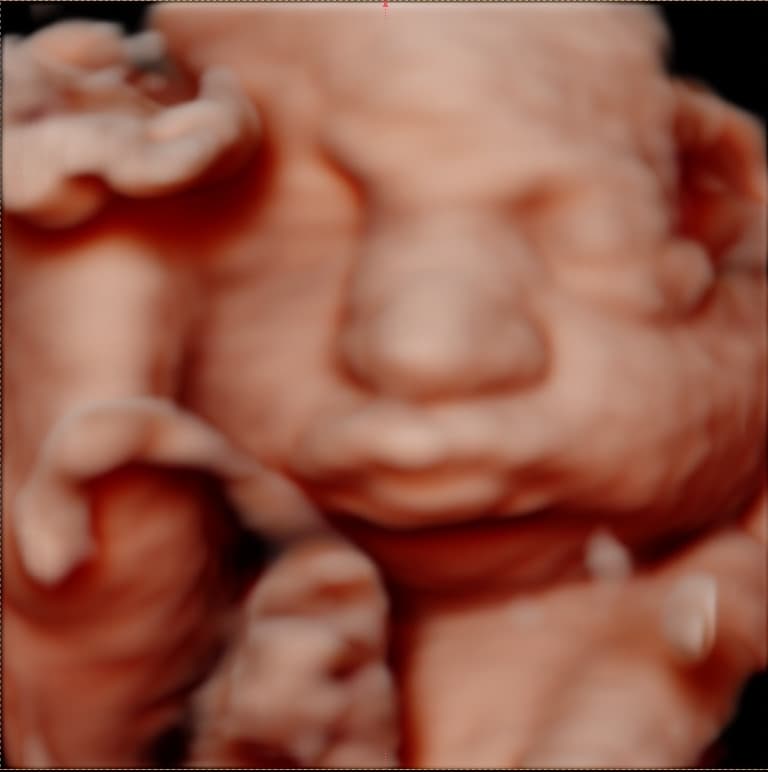 Margarita (expected 08/23)